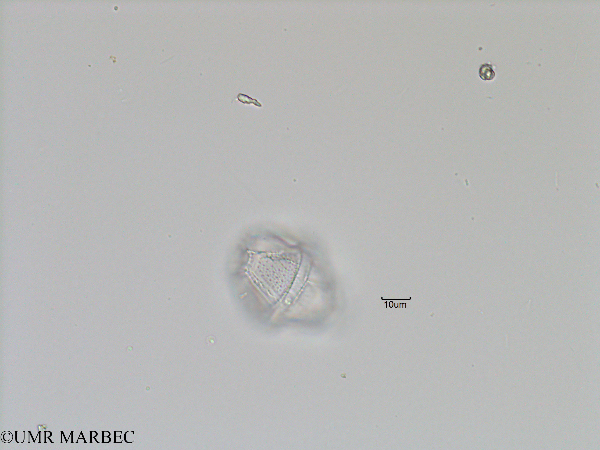 phyto/Bizerte/bizerte_bay/RISCO November 2015/Gonyaulax sp11 (Baie_T5-C2-Gonyaulax cf spinifera-4).tif(copy).jpg